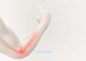 CINEMA4D建模三维立体人体腱鞘炎场景3D模型